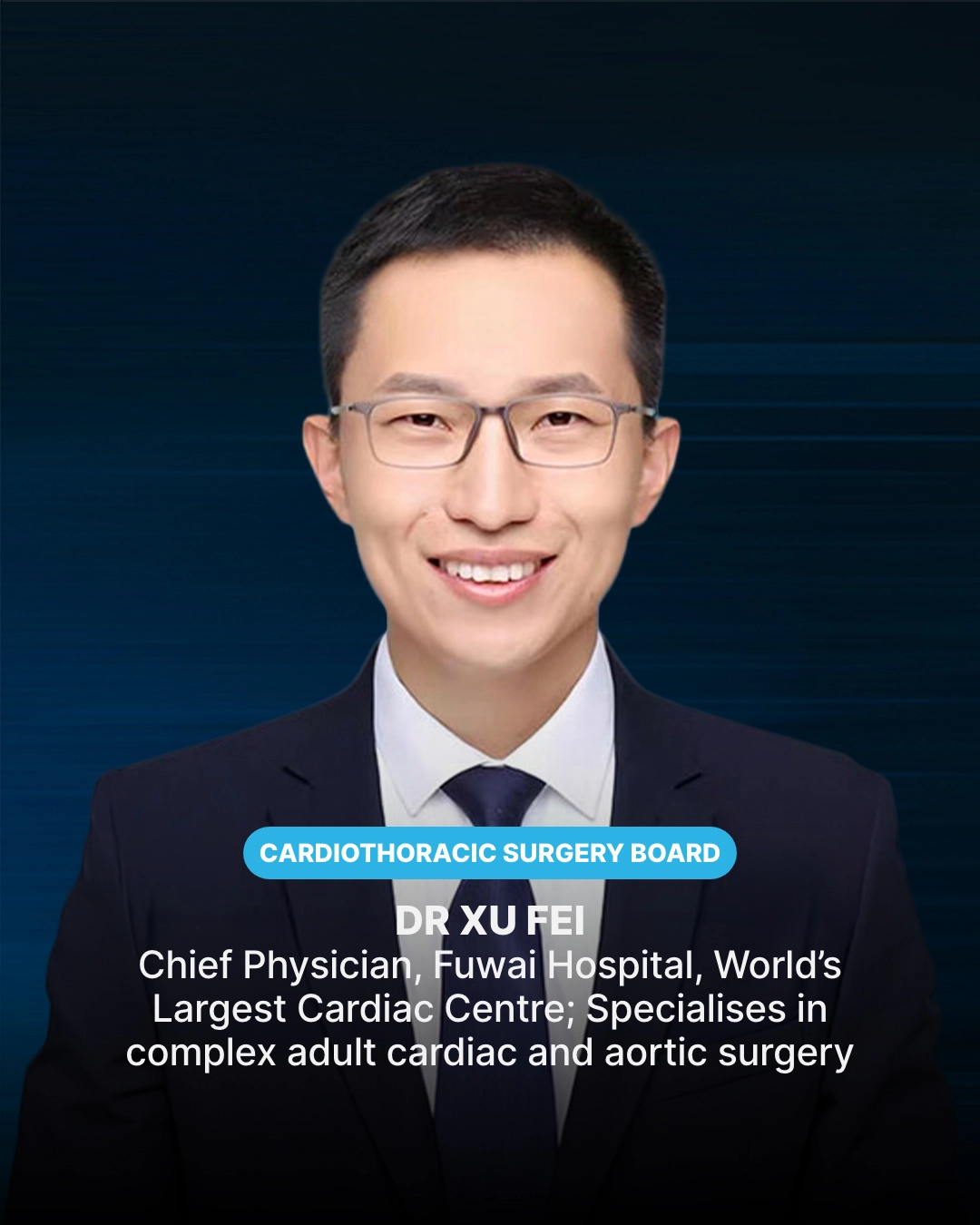 Xu Fei